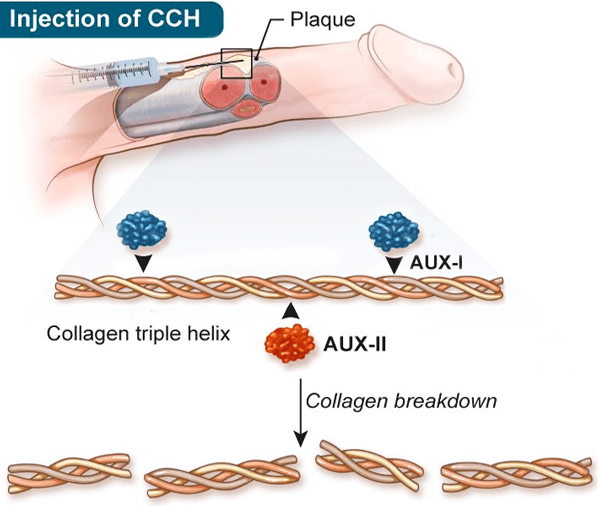 XIAPEX: Behandlungsprotokoll (nicht chirurgisch)